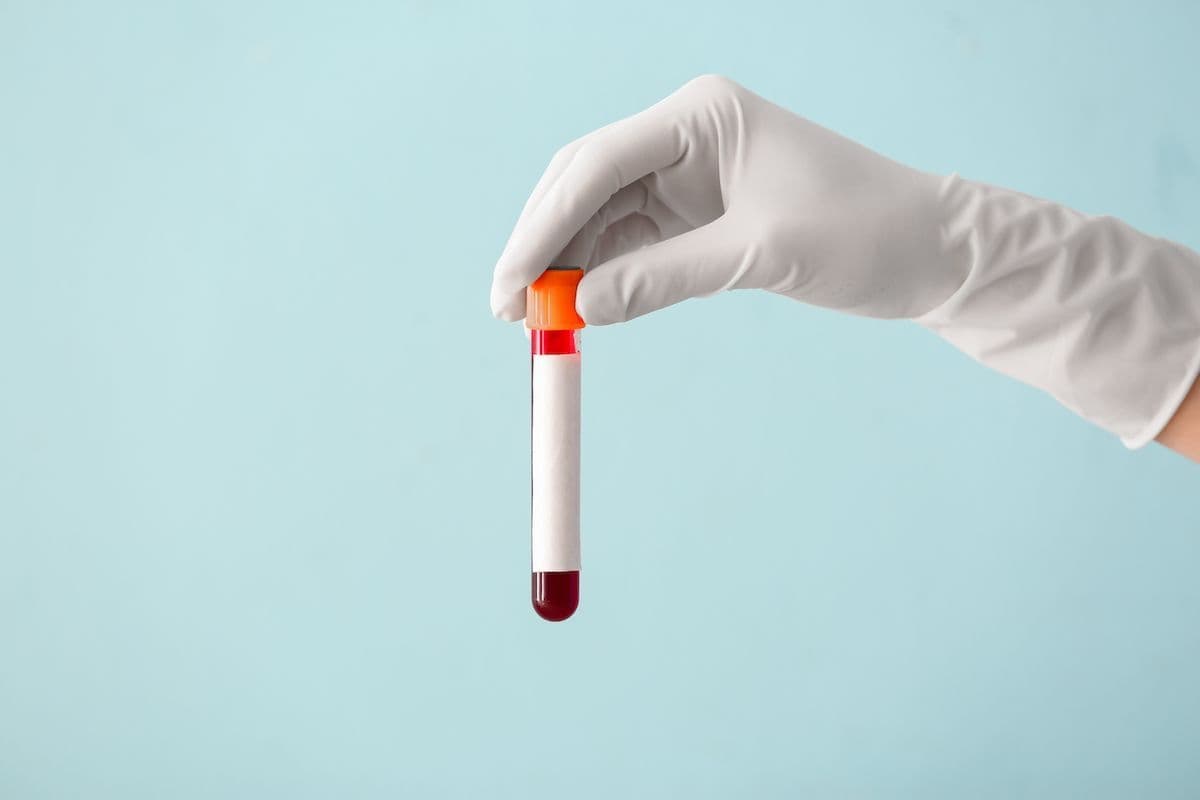 The 'normal' ranges for cholesterol and other blood tests are far from optimal. We asked eight leading metabolic health experts what you should really aim for.