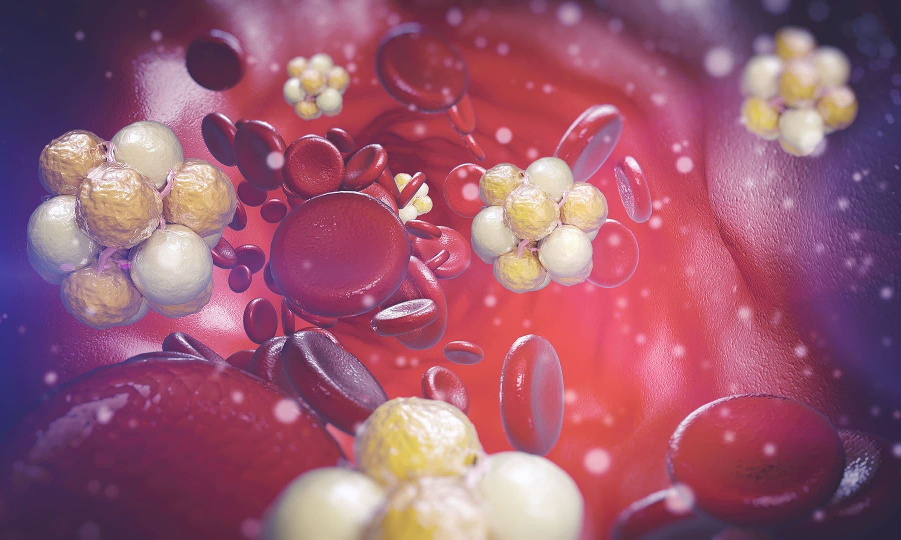 Does cholesterol matter? Metabolic health experts weigh in