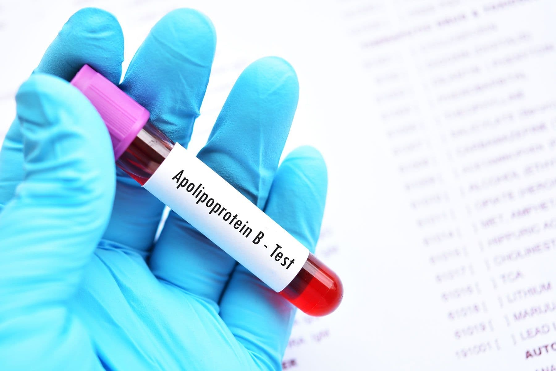 Why ApoB may be a better cholesterol marker