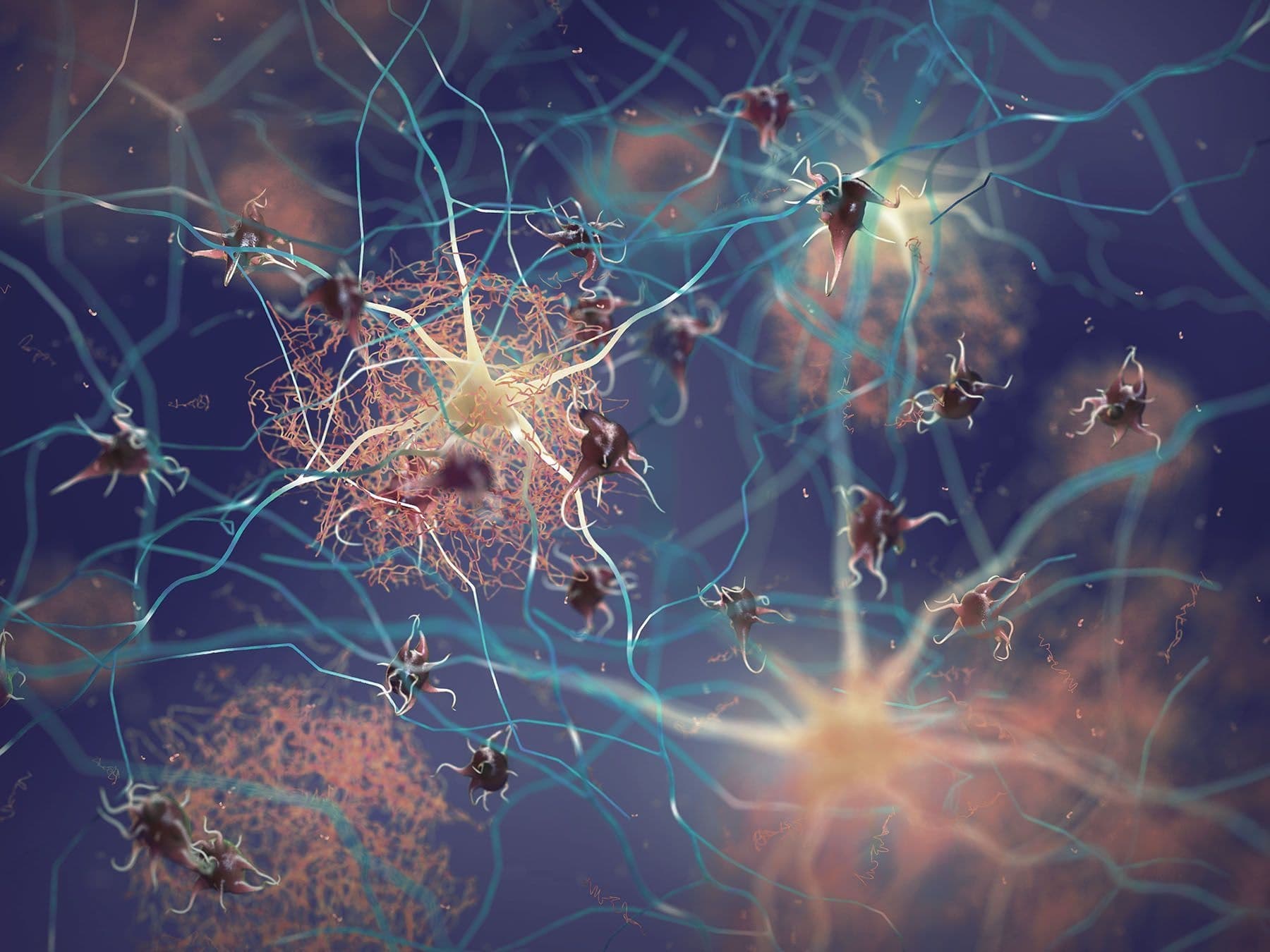 Growing research suggests that Alzheimer’s and dementia are connected to insulin and glucose processing in the brain. Here's what we know