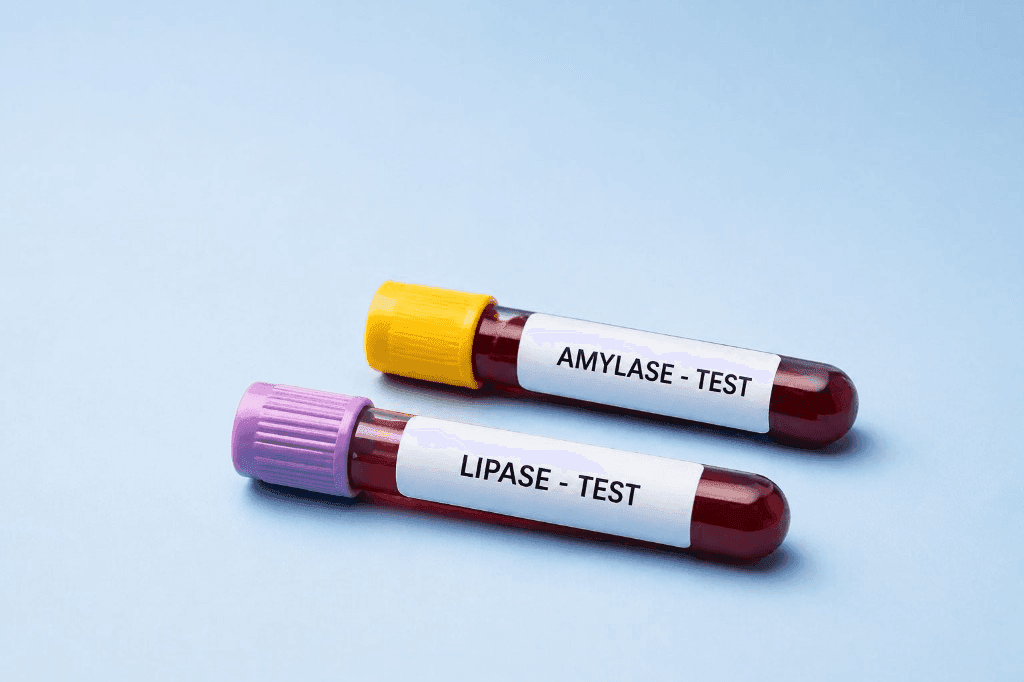 Two labeled blood collection tubes for amylase and lipase tests on a light blue background.